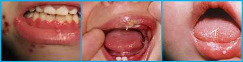 Для новорожденных