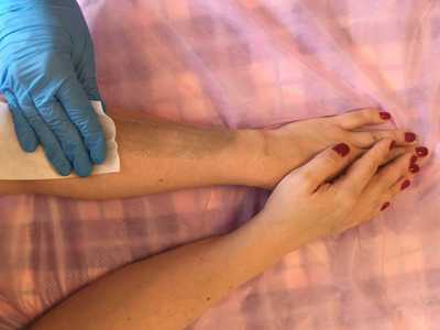 Кожа в области рук нежная, гладкая, при выборе метода удаления нежелательной растительности необходимо учесть обстоятельство