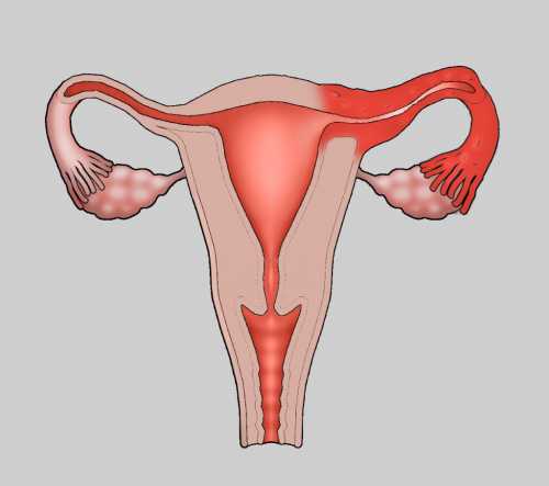 Поскольку развитие аднексита могут спровоцировать разные группы патогенных микроорганизмов, важно подобрать препарат, который проявляет активность в отношении именно того возбудителя, который стал причиной заболевания