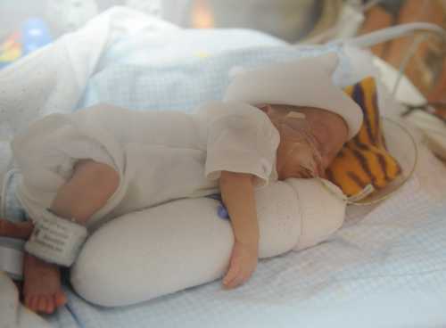 Тесты , Очень часто у детей наблюдается патологическое нарушение питания, которое сопровождается маленьким по сравнению с нормами приростом массы тела по отношению к возрасту и росту