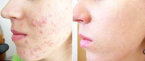 И тогда последствия могут быть весьма печальными