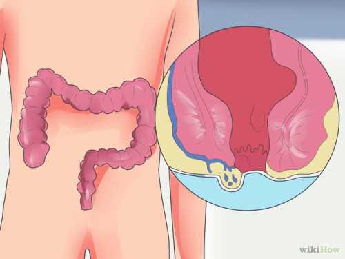 Также проводится стандартный опрос, в ходе которого мужчине потребуется ответить на следующие вопросы