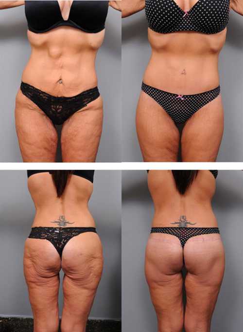 Разведение рук сотягощением