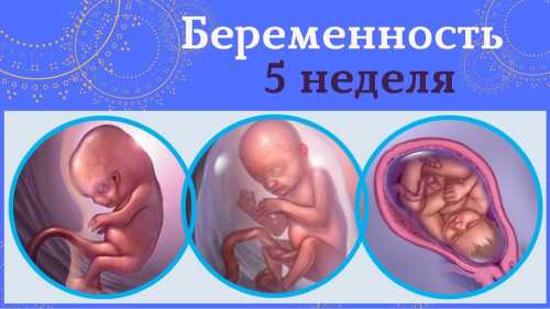5 неделя беременности