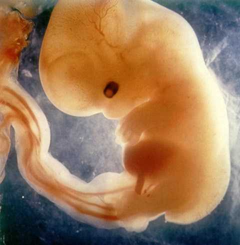 Патологическими считаются выделения ненормального зеленого, серозеленого или желтого цвета, выделения гнойные или створоженные