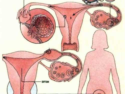 Если же при патологии наблюдаются выделения, по характеру напоминающие природные месячные, тогда это могут быть первые тревожные сигналы разрыва