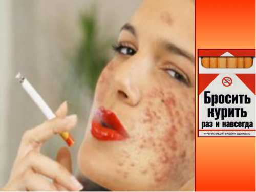 Все изменения необходимо принять и постараться с ними справиться