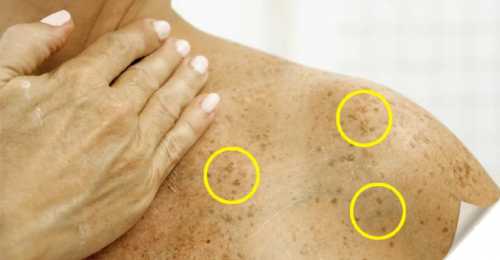 Даже небольшой камушек может вызвать скол