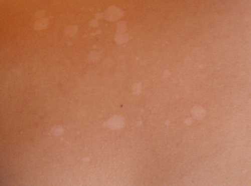 Но нет, это не брак, а особенность технологии