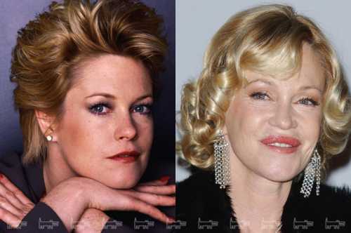 По словам артистки, многие коллеги и публика задавались вопросом, что она с собой сделала