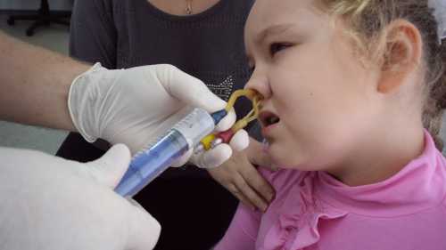 Через катетер в пазуху вводят антисептические вещества