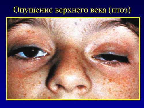 Обычно это касается пожилых людей