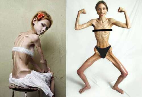 К сожалению, такой метод может помочь снять только синдром дисморфо фобии, с очень хорошим фотографом, при легком случае заболевания, и то временно