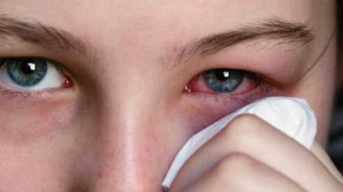 Болят глаза: в чём причина, эта проблема может