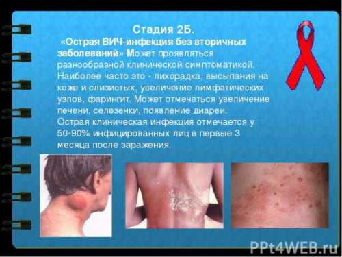 Спид у мужчин: симптомы, причины, это заболевание