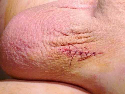 Всегда хочется сохранить красивую внешность, а шрамы это далеко не лучшее украшение