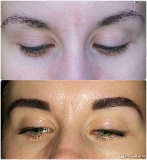 Я так понимаю у всех болевой порог разный