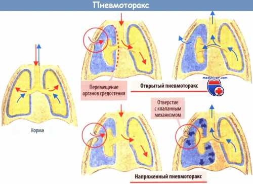В других случаях требуется хирургическое вмешательство