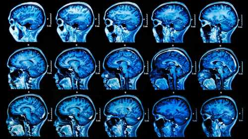 Сканирование мозга может предсказать способность