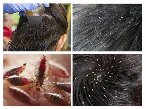 Следует приготовить раствор, смешав столовый уксус с водой в соотношении к