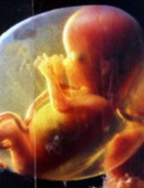 На что это похоже