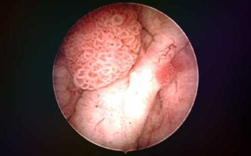 Сигаретный дым содержит большое количество химикатов, которые перерабатываясь оседают в моче