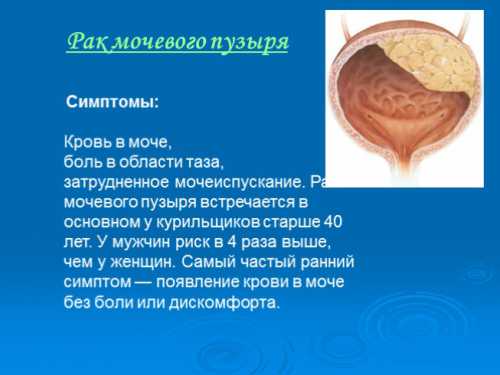 При своевременной диагностике шансы на выздоровление большие стадия