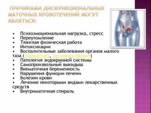 Маточное кровотечение