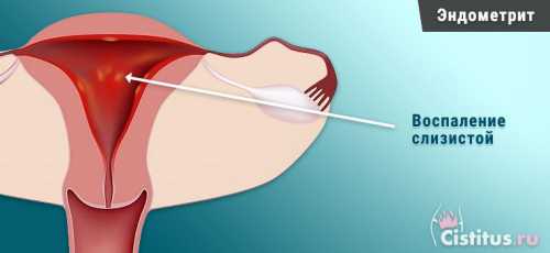 Лечение проводится поэтапно
