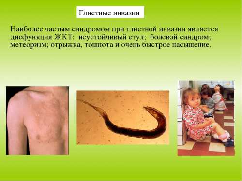 Глистная инвазия