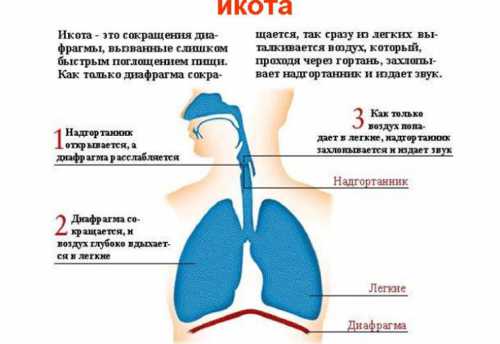 Избавляемся от икоты быстро, причины икоты, что