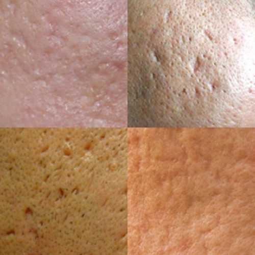 При возникновении сильного жжения, маску тотчас смойте