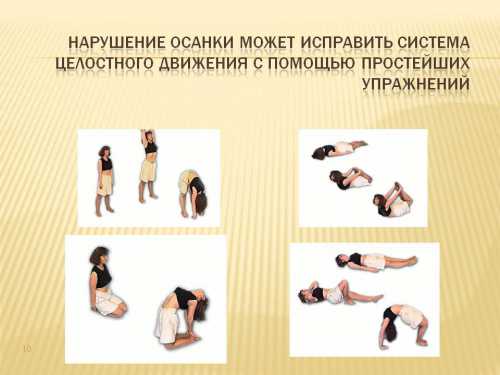 Нарушения осанки Как исправить