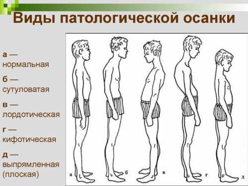На вдохе разверните корпус вправо, при этом заведя руки назад, немного прогнув поясницу, отведя грудную клетку вперёд