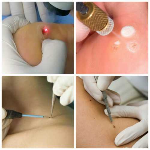 Уход самого близкого человека изменил