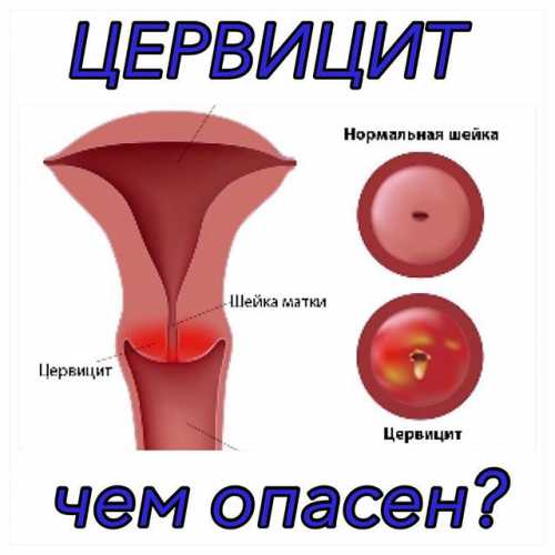 Продолжительность курса составляет сеансов